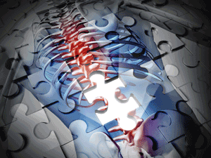 Illustration of the human back spine and rib cage, broken into puzzle pieces with one piece missing