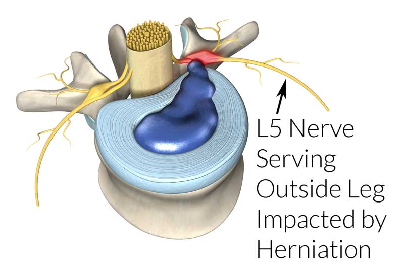 Identifying The Sources Of Low Back Pain