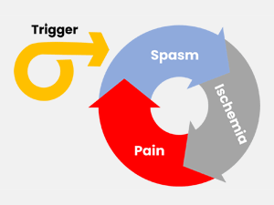 Diagram illustration of how a trigger can start an ongoing pain-spasm-pain cycle