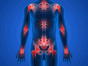 Illustration of potential points of joint pain across mid-body.