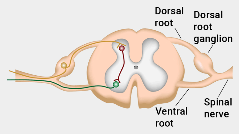 DRG Stimulation For Chronic Regional Pain Syndrome drg-stimulation-for-chronic-regional-pain-syndrome
