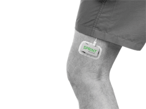External SPRINT PNS Pulse Generator on a leg for knee pain.